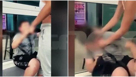 Αδιανόητη βία: Τον βασανίζει και το χαίρεται