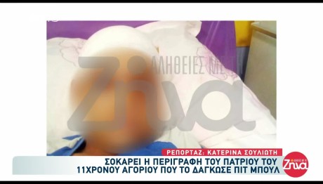 Επίθεση Πιτμπουλ Σε 11χρονο: Σοκάρει Η Περιγραφή Του Πατριού