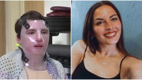 Αντριέλα: 22χρονη Τυλίχθηκε Στις Φλόγες