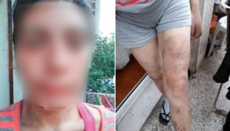 Δολοφονία Φαίης: Τα Στοιχεία Που Δε Δένουν Με Την Ομολογία