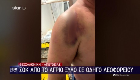 Θεσσαλονίκη: 20χρονοι Ξυλοκόπησαν Άγρια Οδηγού Λεωφορείου