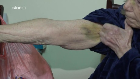 Περιστέρι: Ανήλικη λήστεψε ηλικιωμένη και την έστειλε στο νοσοκομείο