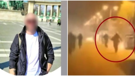 Ακρωτηρίασαν το ένα πόδι του αστυνομικού που τραυματίστηκε στου Ρέντη