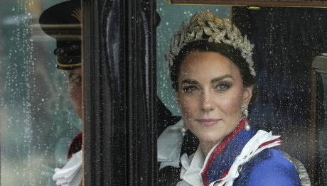 Κέιτ Μίντλετον: Λίγοι Γνώριζαν Για Την Επέμβαση