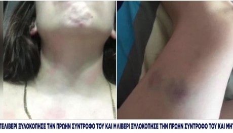 Θεσσαλονίκη: Θύμα ξυλοδαρμού 23χρονη μητέρα βρέφους από τον πρώην σύντροφο