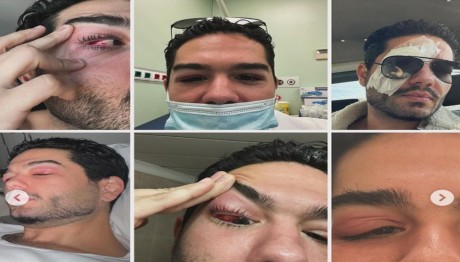 Παγώνη για λοίμωξη Μάστορα:«Δύσκολη περίπτωση, σιγά σιγά θα αντιμετωπιστεί»