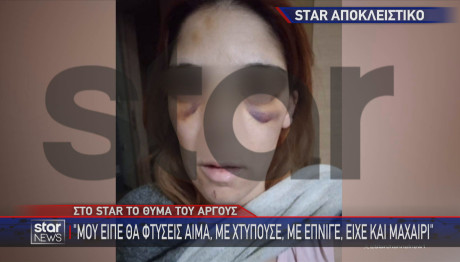 Άργος: Σοκάρει Η Περιγραφή Της Ελένης Που Κακοποιήθηκε