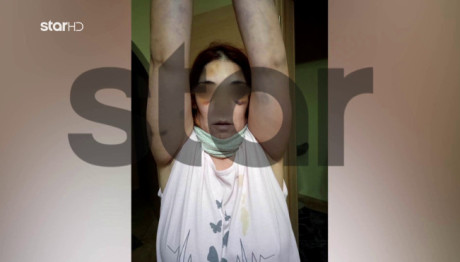 Άργος: Μου Έλεγε Ότι Θα Με Σκοτώσει Και Θα Κάψει Τα Παιδιά