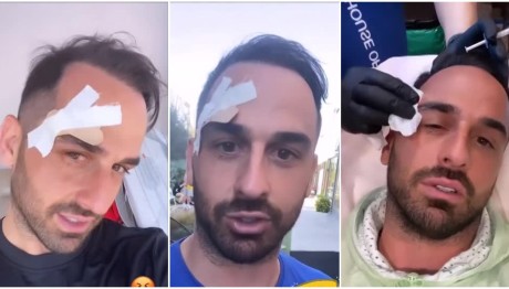 Άρης Σοϊλέδης: Χρειάστηκε να κάνει ράμματα - «Η κατάρα συνεχίζεται»