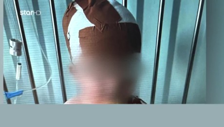 Νέα Σμύρνη: Χειρουργήθηκε το 11 μηνών μωρό που δάγκωσε ο σκύλος του σπιτιού