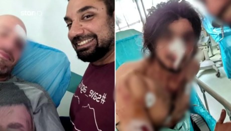 Πάρνηθα: Πώς 'Εγινε Η Άγρια Επίθεση Στους Εθελοντές