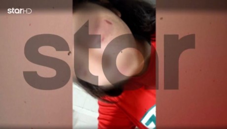 Κρήτη: Άγριος Ξυλοδαρμός 14χρονης Από Συμμαθήτριες