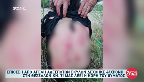 Θεσσαλονίκη: Άγρια Επίθεση Αγέλης Σκύλων Σε 44χρονη Μητέρα