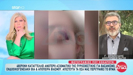 Καταγγελία Για Βασανιστήρια Από Αξιωματικό Πυροσβεστικής