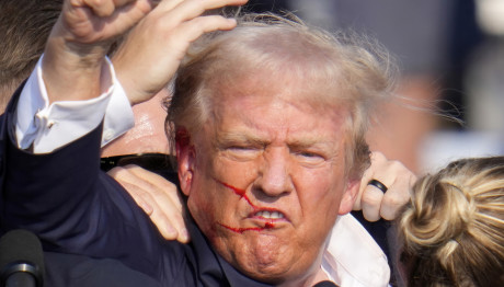 Ντόναλντ Τραμπ: Από Θαύμα Γλίτωσα - Οι Πρώτες Δηλώσεις