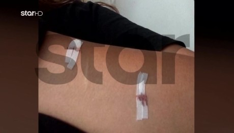 Ενδοοικογενειακή Βία: Τη Μαχαίρωσε Και Διέρρευσε Ροζ Βίντεο