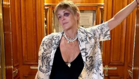 Σάρον Στόουν: Με Μαυρισμένο Μάτι Σε Φωτογραφία Από Διακοπές