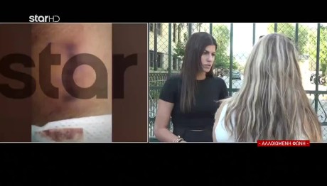 Λούτσα: Ξεσπά Η Σύζυγος Του Φαρμακοποιού Για Τον Ξυλοδαρμό