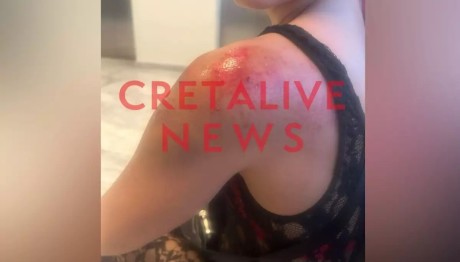 Κρήτη: Τη Χτύπησε Με Τη Μηχανή Και Την Έσερνε Στον Δρόμο