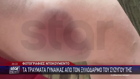 Ξυλοκοπούσε Τη Σύζυγό Του Ακόμη Κι Όταν Ήταν Έγκυος