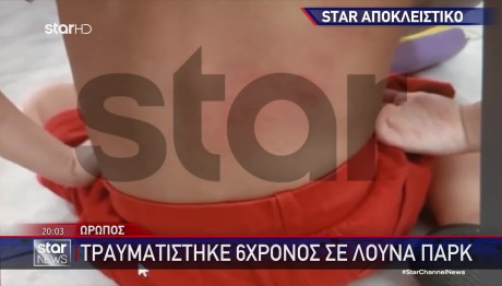 Ωρωπός: Και Νέο Ατύχημα Σε Λούνα Παρκ Με Θύμα Έναν 6χρονο