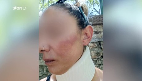 Λέσβος: Η Σύντροφος Του Πυροσβέστη Για Τον Ξυλοδαρμό