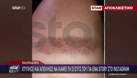 Χαλκιδική: Ξυλοκόπησε Τη Σύζυγό Του Για Ένα Story