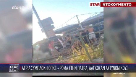 Πάτρα: Ρομά Δάγκωσαν Αστυνομικό Μετά Από Συμπλοκή