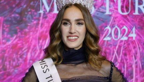 Σάλος Με Τη Μις Τουρκία 2024 - «Είναι Σαν Άνδρας»