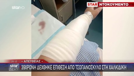 Χαλκιδική: Τσοπανόσκυλο Επιτέθηκε σε 39χρονη