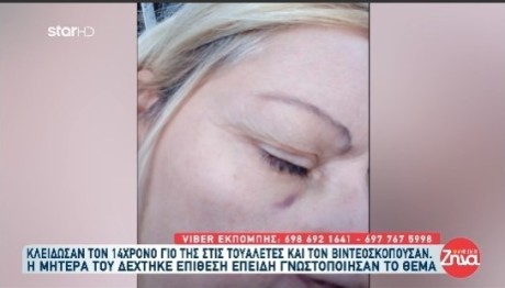 Θεσσαλονίκη: Χτύπησαν Μητέρα 14χρονου Σε Σχολείο