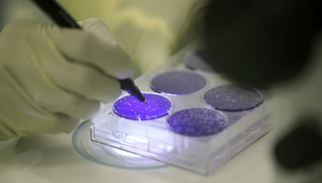 Καρκίνος Παχέος Εντέρου: 1.000 Θετικά Self Test Έως Τώρα