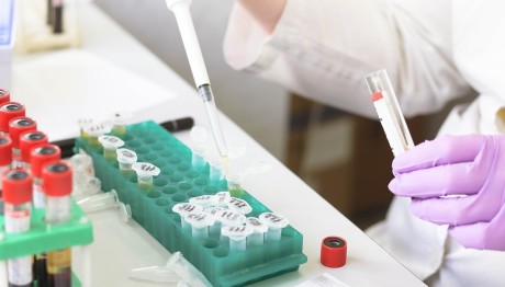 Καρκίνος Παχέος Εντέρου