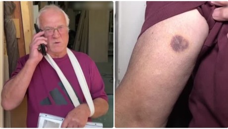 Γλυκά Νερά: Τι Λέει Ο Σκηνοθέτης Για Τον Ξυλοδαρμό 72χρονου