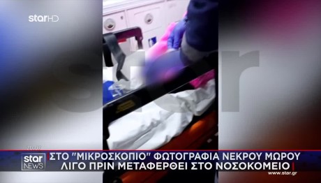 Αμαλιάδα: «Υποψία αλλοιώσεων στη μύτη του 6 μηνών μωρού»