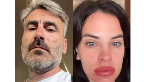 Μαυρίδης: Τρολάρει Την Μπόμπα Για Το Πρήξιμο Στα Χείλη Της