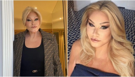 Τζόσλιν Γουαϊλντενστάιν