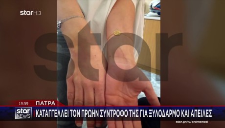 Πάτρα: Καταγγέλει Τον Πρώην Σύντροφό Της Για Ξυλοδαρμό