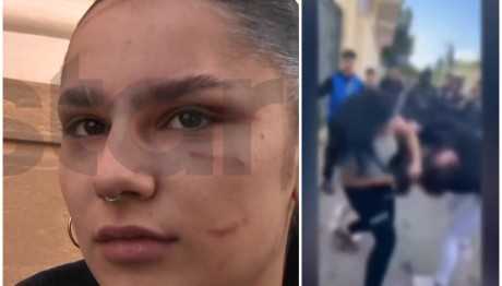 Πάτρα: Ξεσπά Η 18χρονη Για Την Επίθεση Που Δέχθηκε Στο ΕΠΑΛ