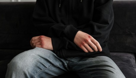 Κρυονέρι: Επίθεση σε παρέα ανηλίκων- Γρονθοκόπησαν δύο 17χρονους