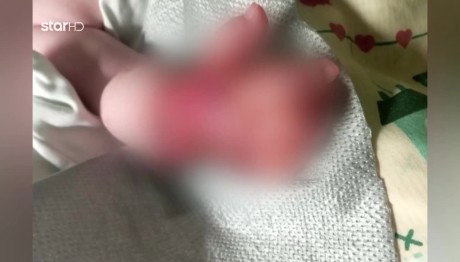 Βόλος: Ίσως Νεκρωθεί Το Χεράκι Του Βρέφους
