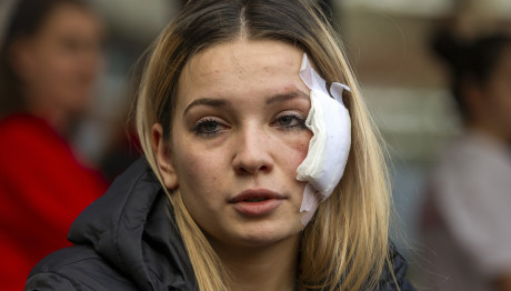 Βόρεια Μακεδονία: Συγκλονίζουν Οι Μαρτυρίες Επιζώντων