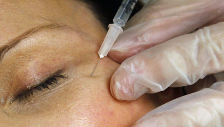 Botox