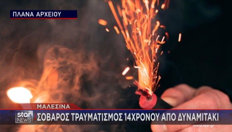 Πάσχα: Τραυματισμοί Και Ακρωτηριασμοί Από Βεγγαλικά