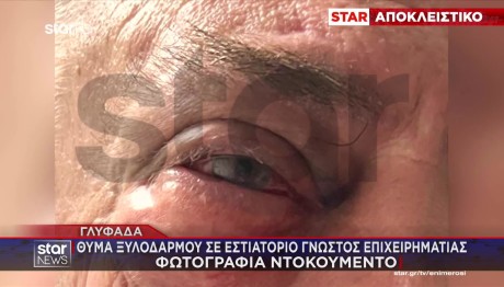 Γλυφάδα: Ξυλοδαρμός Επιχειρηματία Σε Γνωστό Εστιατόριο