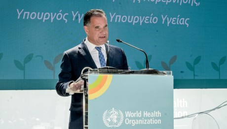 Άδωνις Γεωργιάδης: Επιβεβαίωσε Τη Μεταμόσχευση Μαλλιών