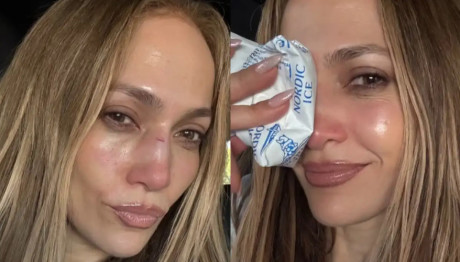 Τζένιφερ Λόπεζ – Τραυματίστηκε κατά τη διάρκεια πρόβας