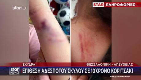 Άγρια Επίθεση Αδέσποτου Σκύλου Σε 10χρονη Στη Σκύδρα