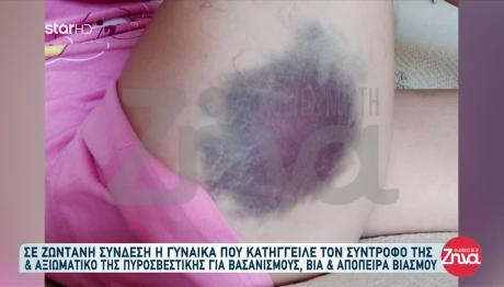 Με Έδερνε Ο Σύντροφός Μου Γιατί Του Έφτιαχνα Καφέ