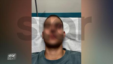 Χαλκίδα: 20χρονος Έπεσε Θύμα Άγριας Επίθεσης